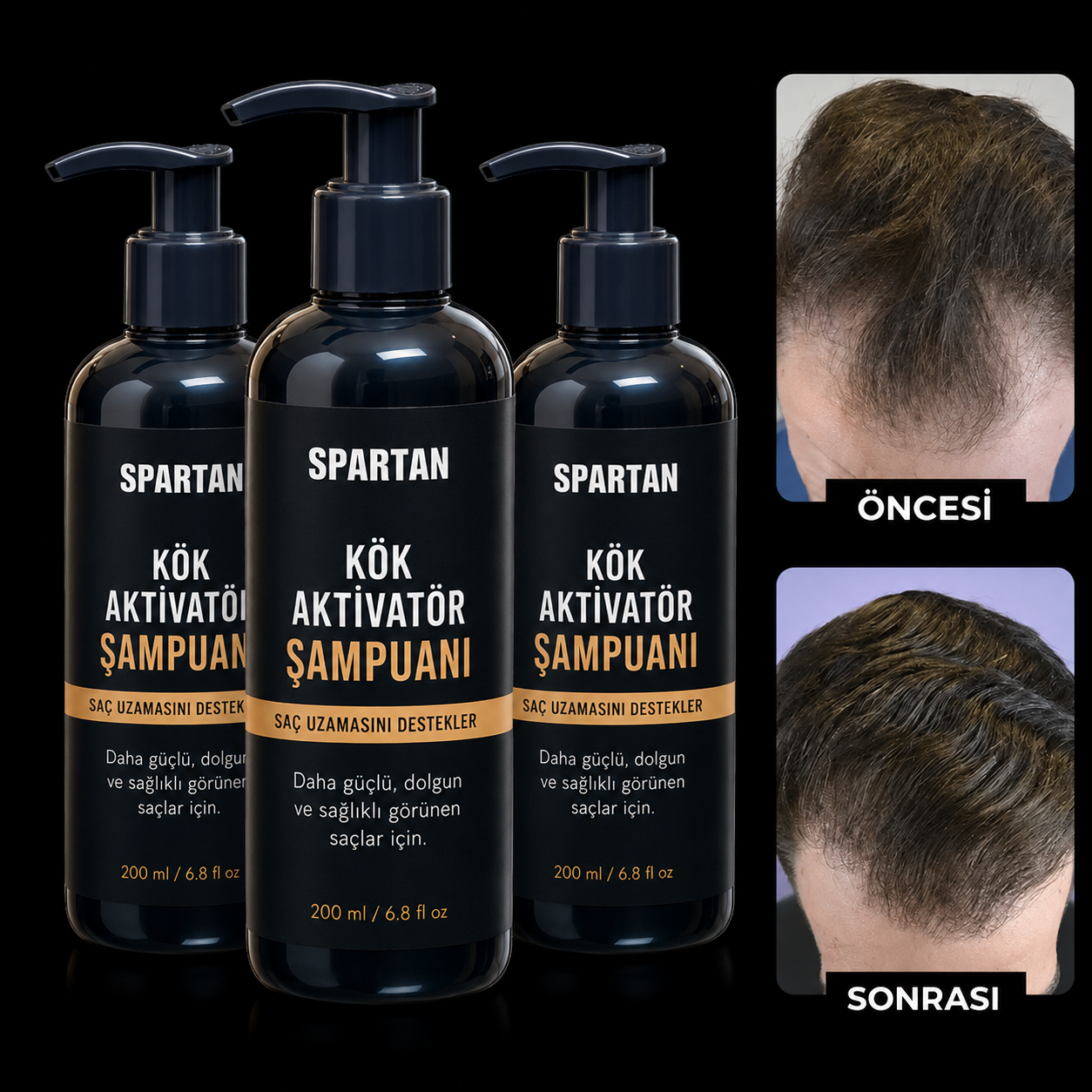 Spartan Kök Aktivatör Şampuan