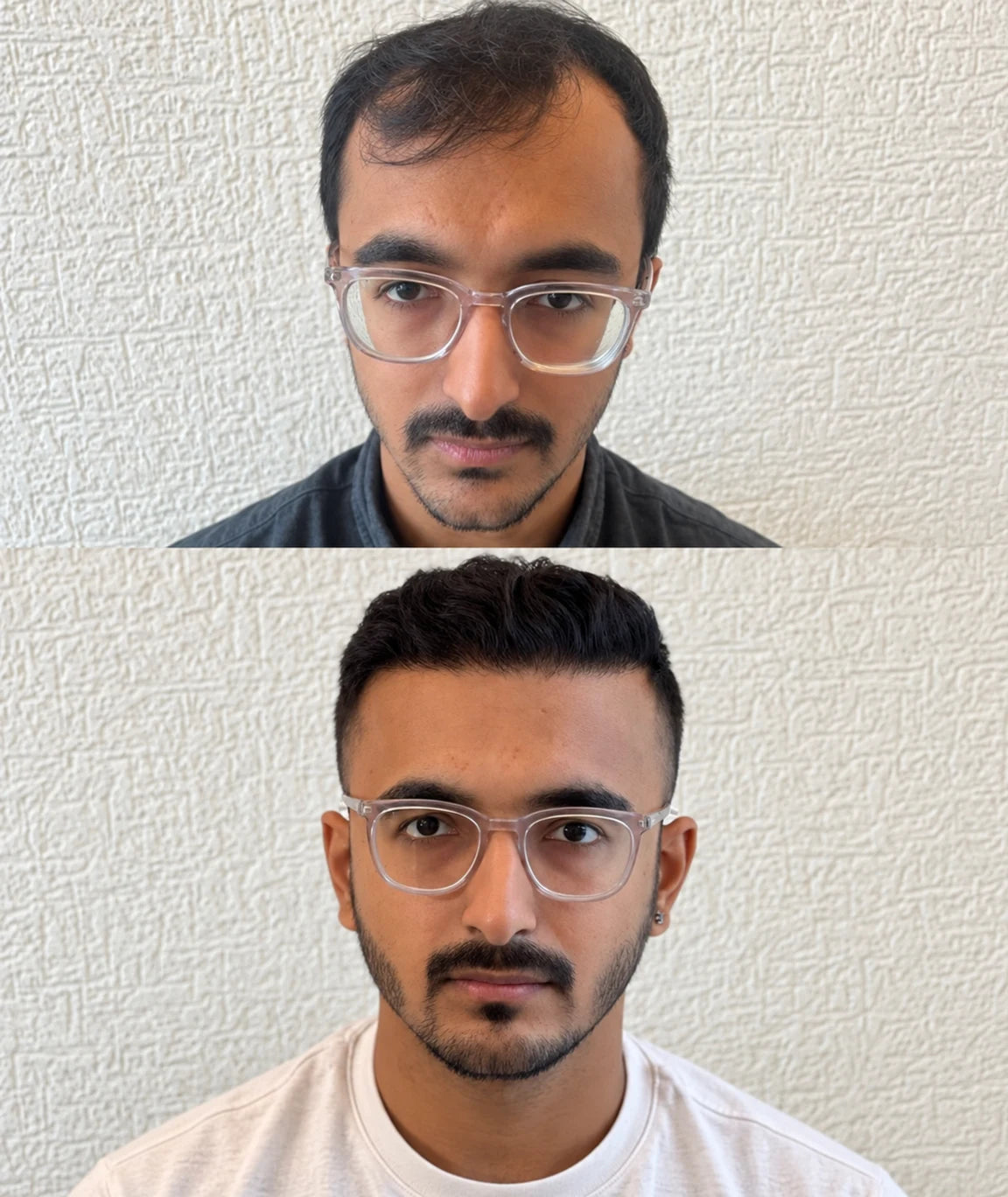 Saç görünümünü iki çekimde gösteren anonim paylaşım 14
