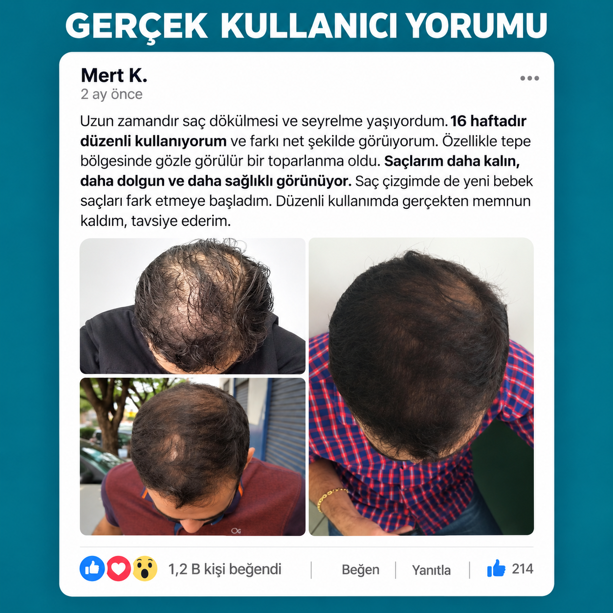 Spartan şampuan deneyimini üç fotoğrafla paylaşan kullanıcı yorumu