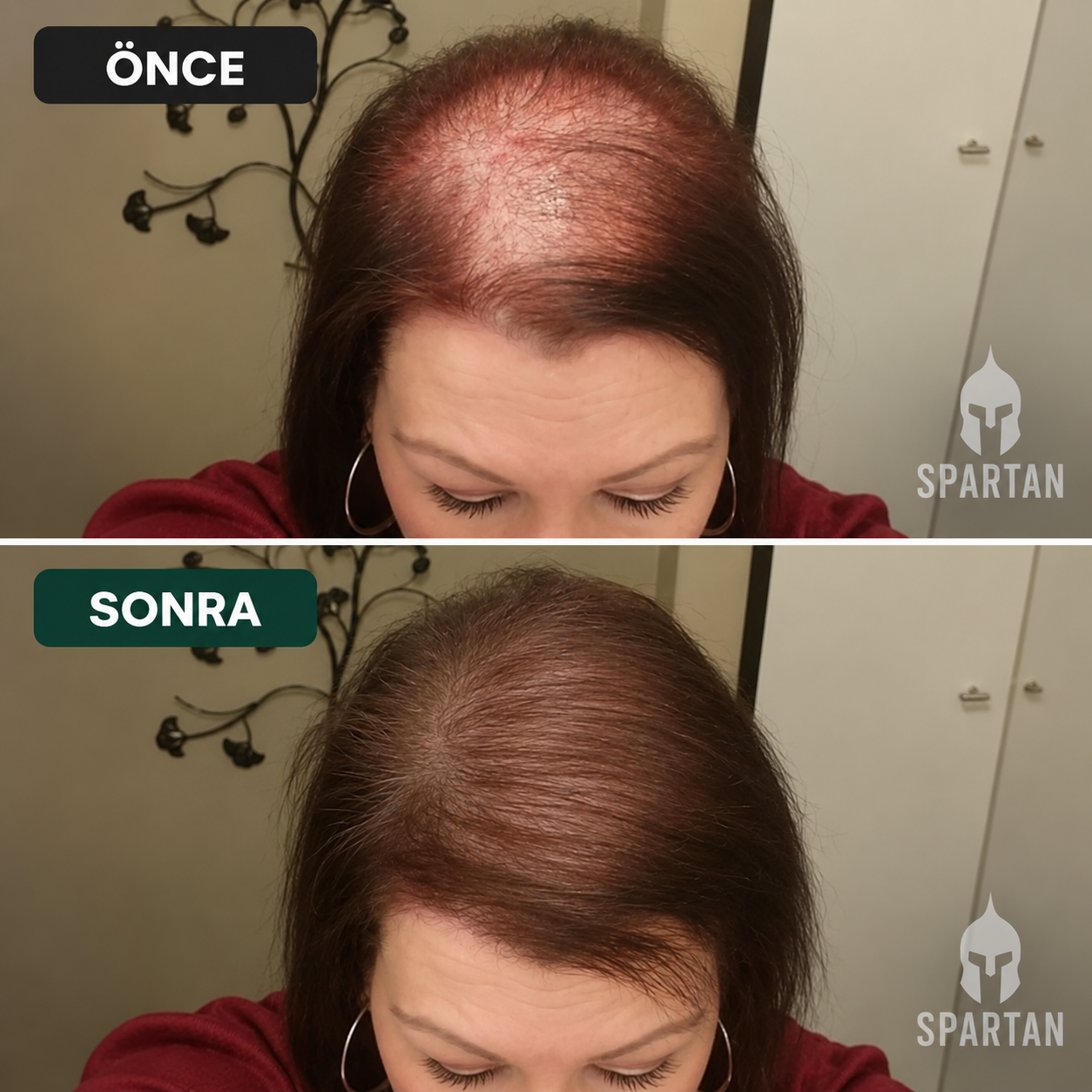 Kadın kullanıcının saç görünümünü iki karede karşılaştıran fotoğraf